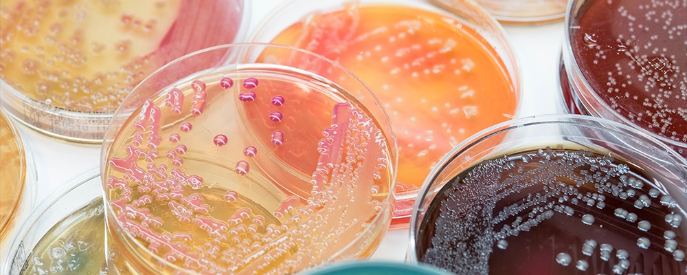 Read more about the article Custom Enzyme Blends: Tailoring Solutions for Industrial Challenges